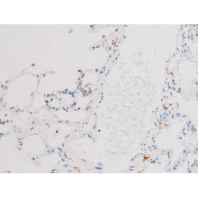 Polyclonal Rabbit anti-Human SMAD3 Antibody (phospho-Thr8, IHC, WB)