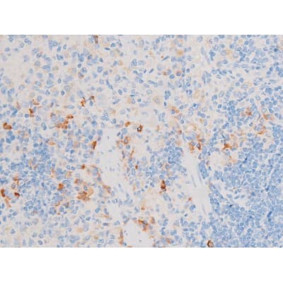 Polyclonal Rabbit anti-Human SMAD3 Antibody (phospho-Thr8, IHC, WB)
