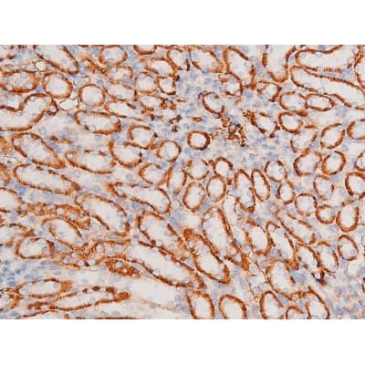 XIAP Antibody (phospho-Ser87)