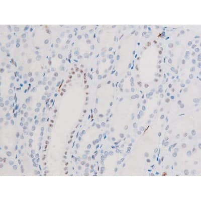 Polyclonal Rabbit anti-Human FOXO4 / AFX1 Antibody (phospho-Thr451, IHC, IF, WB)