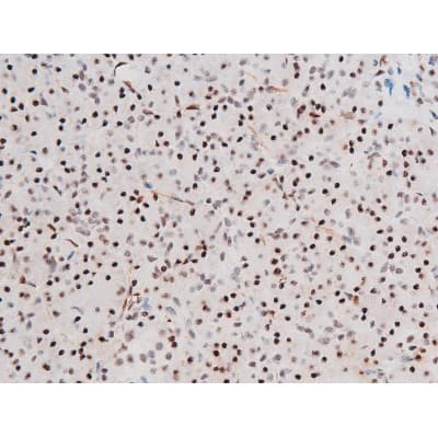 Polyclonal Rabbit anti-Human FOXO4 / AFX1 Antibody (phospho-Thr451, IHC, IF, WB)
