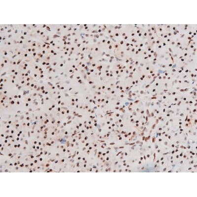 Polyclonal Rabbit anti-Human FOXO4 / AFX1 Antibody (phospho-Thr451, IHC, IF, WB)