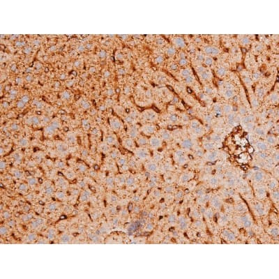 Polyclonal Rabbit anti-Human FOXO4 / AFX1 Antibody (phospho-Thr451, IHC, IF, WB)