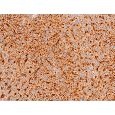 Polyclonal Rabbit anti-Human FOXO4 / AFX1 Antibody (phospho-Thr451, IHC, IF, WB)