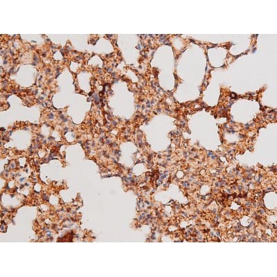 Polyclonal Rabbit anti-Human FOXO4 / AFX1 Antibody (phospho-Thr451, IHC, IF, WB)