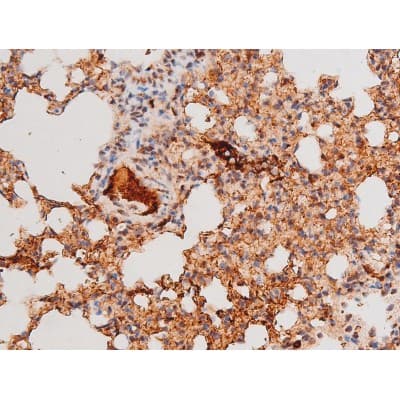 Polyclonal Rabbit anti-Human FOXO4 / AFX1 Antibody (phospho-Thr451, IHC, IF, WB)