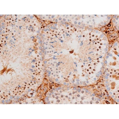 Polyclonal Rabbit anti-Human FOXO4 / AFX1 Antibody (phospho-Thr451, IHC, IF, WB)