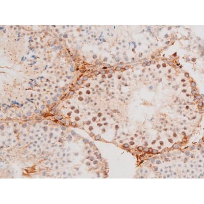 Polyclonal Rabbit anti-Human FOXO4 / AFX1 Antibody (phospho-Thr451, IHC, IF, WB)