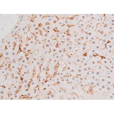 Polyclonal Rabbit anti-Human FOXO4 / AFX1 Antibody (phospho-Thr451, IHC, IF, WB)