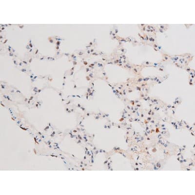 Polyclonal Rabbit anti-Human FOXO4 / AFX1 Antibody (phospho-Thr451, IHC, IF, WB)