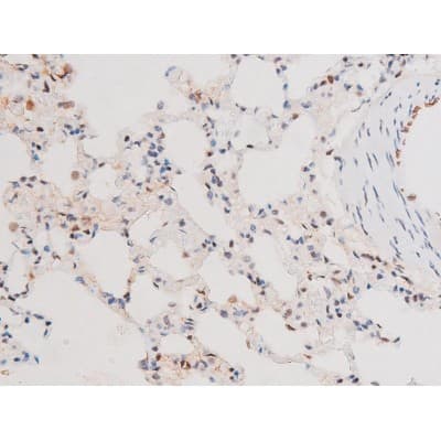 Polyclonal Rabbit anti-Human FOXO4 / AFX1 Antibody (phospho-Thr451, IHC, IF, WB)