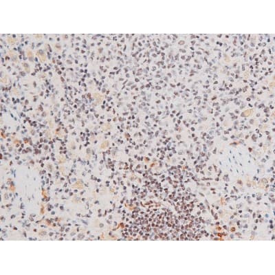 Polyclonal Rabbit anti-Human FOXO4 / AFX1 Antibody (phospho-Thr451, IHC, IF, WB)