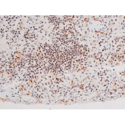 Polyclonal Rabbit anti-Human FOXO4 / AFX1 Antibody (phospho-Thr451, IHC, IF, WB)