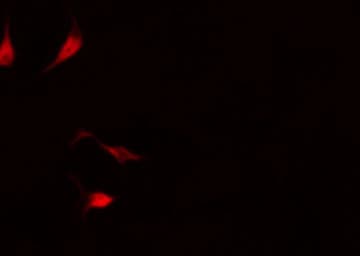 Polyclonal Rabbit anti-Human FOXO4 / AFX1 Antibody (phospho-Thr451, IHC, IF, WB)