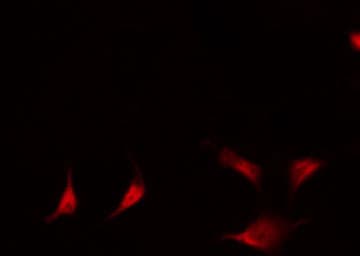 Polyclonal Rabbit anti-Human NFKB2 Antibody (phospho-Ser869, IHC, IF, WB)