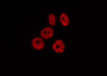 RELA / NFKB p65 Antibody (phospho-Ser276)
