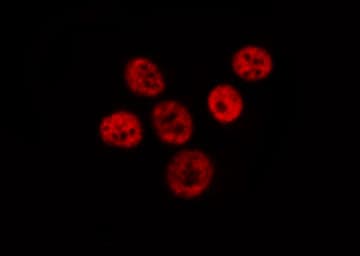 RELA / NFKB p65 Antibody (phospho-Ser529)