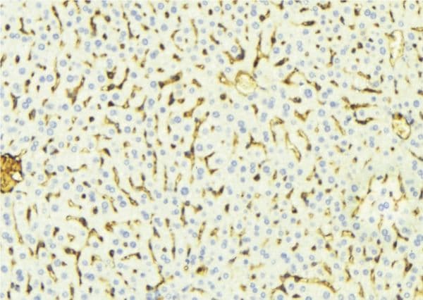 Polyclonal Rabbit anti-Human Alpha-Fetoprotein Antibody (IHC, WB)