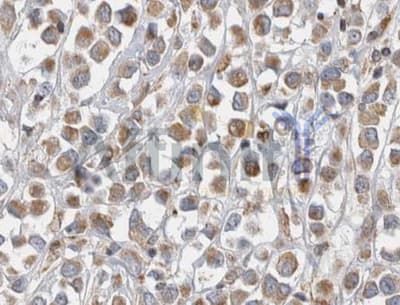 Polyclonal Rabbit anti-Human Alpha-Fetoprotein Antibody (IHC, WB)