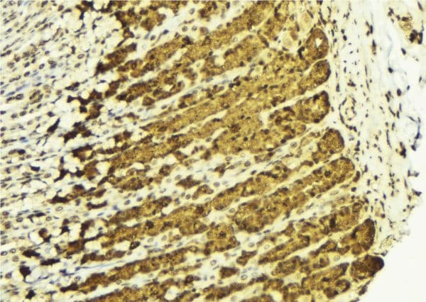 Polyclonal Rabbit anti-Human CHUK / IKKA / IKK Alpha Antibody (IHC, IF, WB)