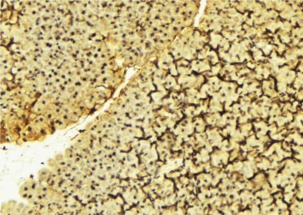 Polyclonal Rabbit anti-Human PDPK1 / PDK1 Antibody (IHC, WB)
