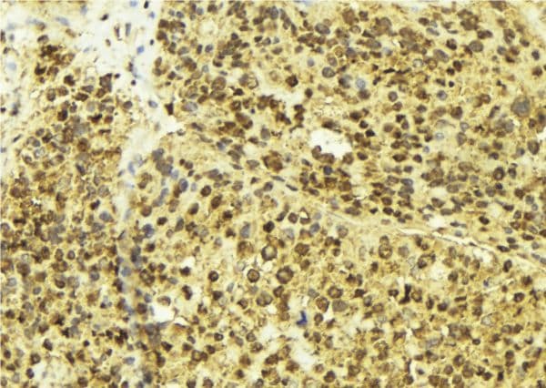 Polyclonal Rabbit anti-Human MITF Antibody (IHC, IF, WB)