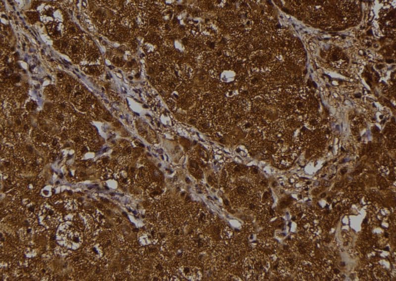 Polyclonal Rabbit anti-Human EIF2S1 Antibody (IHC, IF, WB)