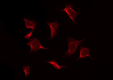 Polyclonal Rabbit anti-Human EIF2S1 Antibody (IHC, IF, WB)