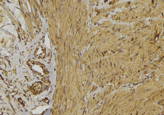 Polyclonal Rabbit anti-Human ADRB2 Antibody (IHC, IF, WB)
