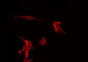 Polyclonal Rabbit anti-Human ADRB2 Antibody (IHC, IF, WB)