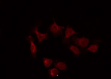 Polyclonal Rabbit anti-Human SP1 Antibody (IHC, IF, WB)