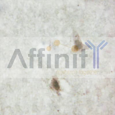 Polyclonal Rabbit anti-Human SP1 Antibody (IHC, IF, WB)