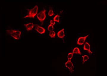 Polyclonal Rabbit anti-Human IGF1R / IGF1 Receptor Antibody (IF, WB)