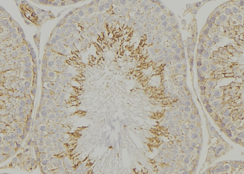Polyclonal Rabbit anti-Human VAV1 / VAV Antibody (IHC, IF, WB)