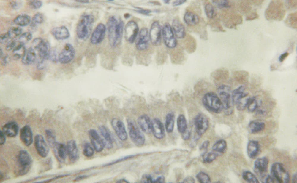 Polyclonal Rabbit anti-Human VAV1 / VAV Antibody (IHC, IF, WB)