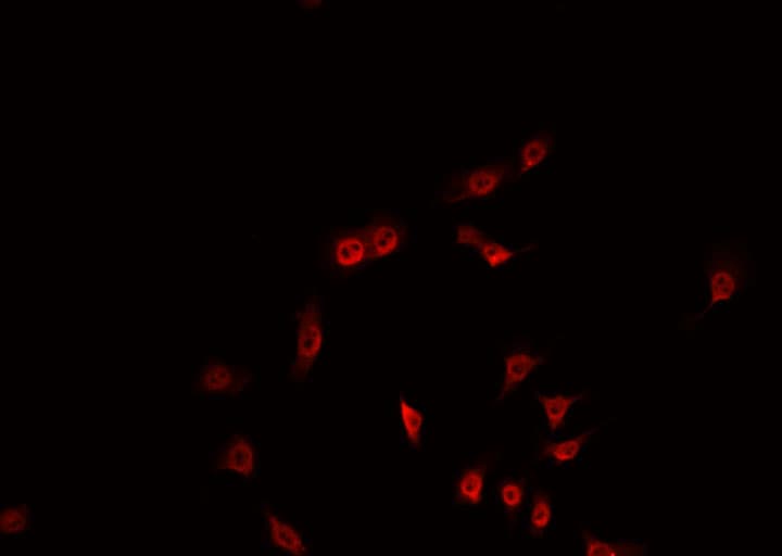 Polyclonal Rabbit anti-Human CREB1 / CREB Antibody (IHC, IF, WB)