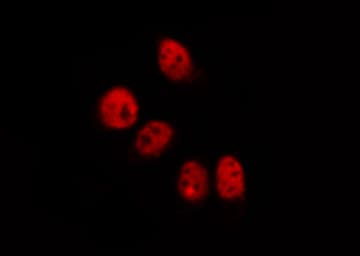 Polyclonal Rabbit anti-Human CREB1 / CREB Antibody (IHC, IF, WB)