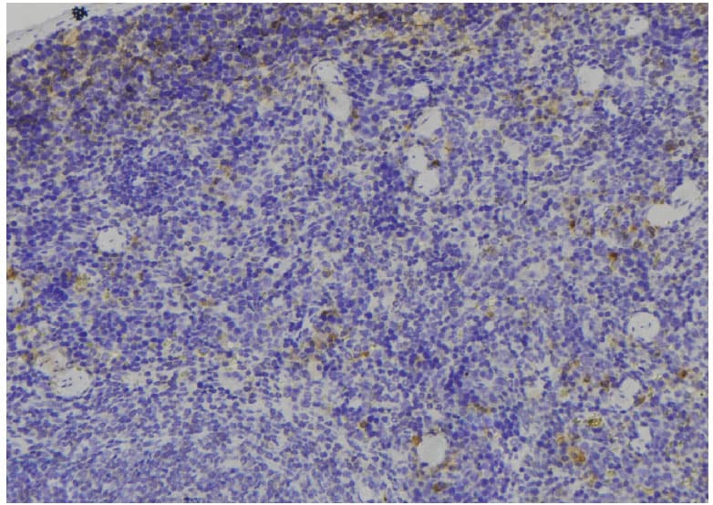 Polyclonal Rabbit anti-Human IGFBP3 Antibody (IHC, WB)