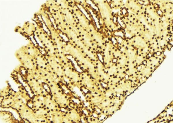 Polyclonal Rabbit anti-Human RPS6KB1 / P70S6K / S6K Antibody (IHC, IF, WB)