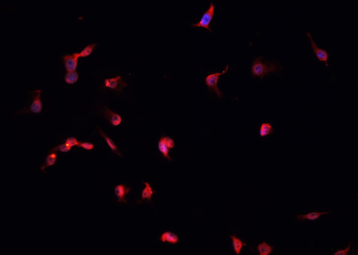 Polyclonal Rabbit anti-Human RPS6KB1 / P70S6K / S6K Antibody (IHC, IF, WB)