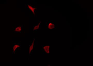 Polyclonal Rabbit anti-Human RPS6KB1 / P70S6K / S6K Antibody (IHC, IF, WB)