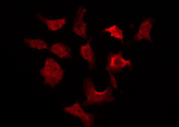 AKT1 Antibody