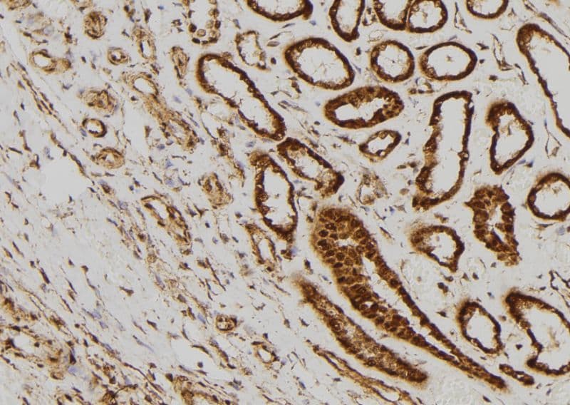 Polyclonal Rabbit anti-Human AKT2 Antibody (IHC, IF, WB)