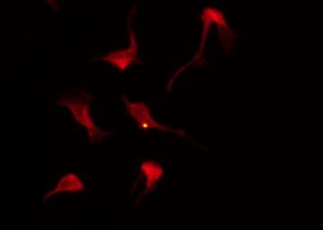 Polyclonal Rabbit anti-Human AKT2 Antibody (IHC, IF, WB)