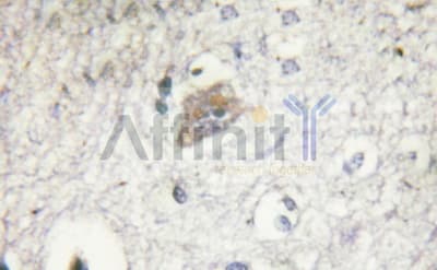 Polyclonal Rabbit anti-Human VHL / Von Hippel Lindau Antibody (IHC, WB)