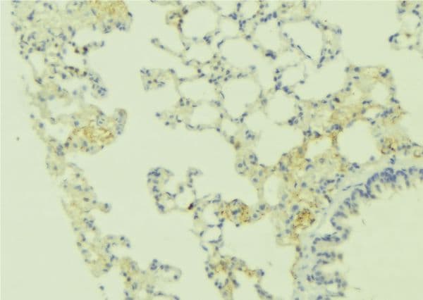 Polyclonal Rabbit anti-Human CASR/Calcium Sensing Receptor Antibody (IHC, IF, WB)
