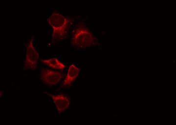 Polyclonal Rabbit anti-Human CASR/Calcium Sensing Receptor Antibody (IHC, IF, WB)