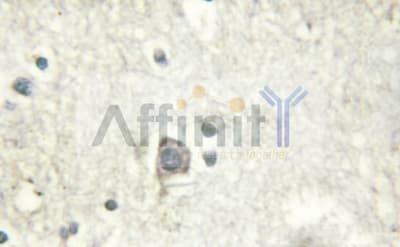 Polyclonal Rabbit anti-Human CASR/Calcium Sensing Receptor Antibody (IHC, IF, WB)