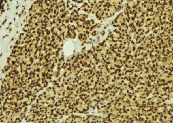 Polyclonal Rabbit anti-Human MAPK8 / JNK1 Antibody (IHC, IF, WB)