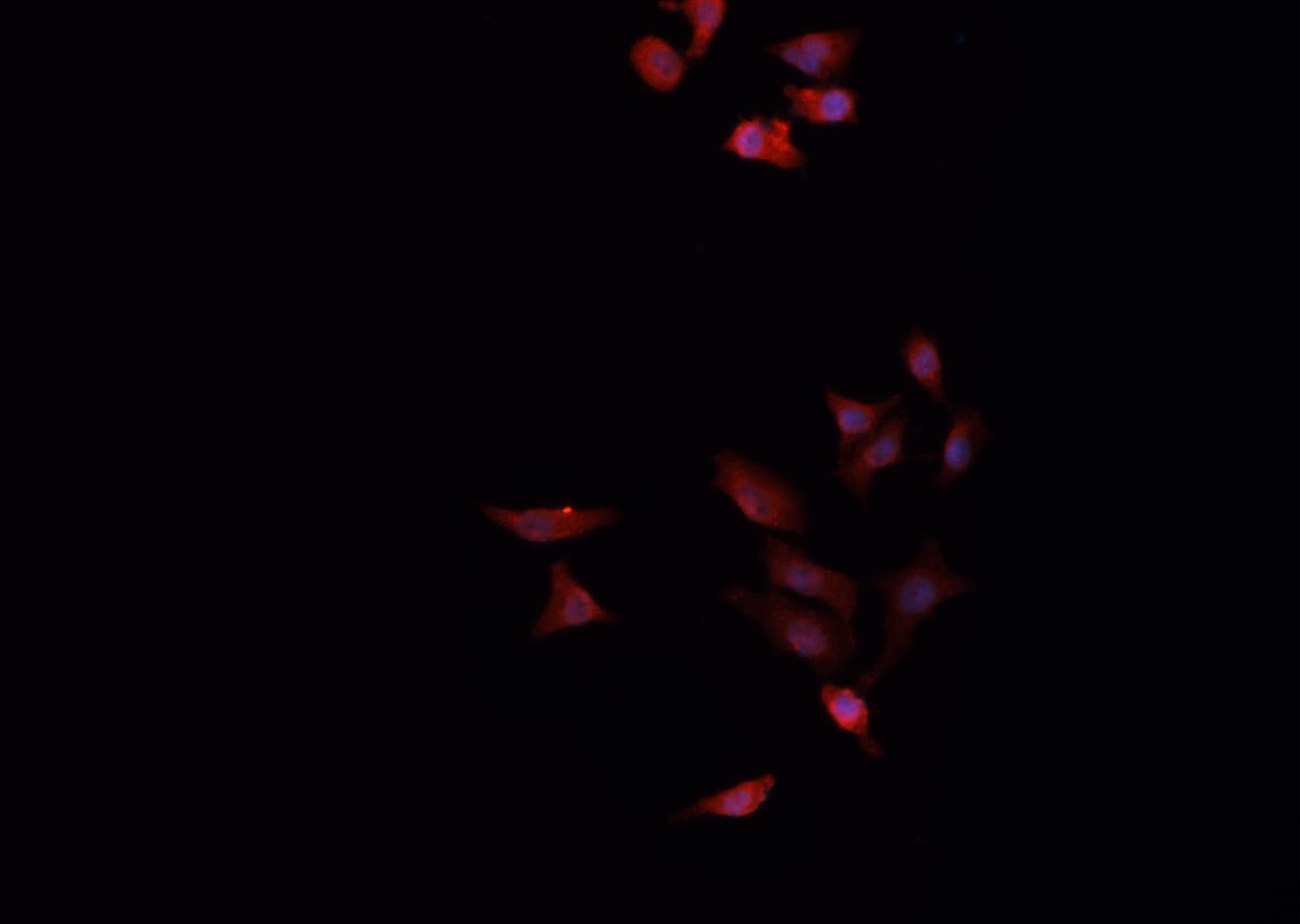 Polyclonal Rabbit anti-Human MAPK8 / JNK1 Antibody (IHC, IF, WB)